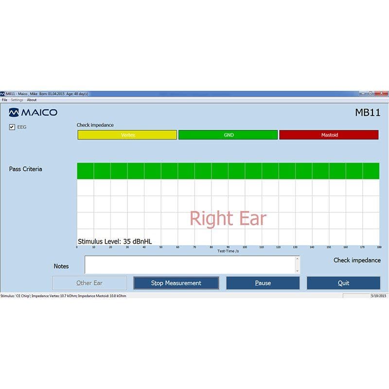 xmb11_beraphone12_800x800