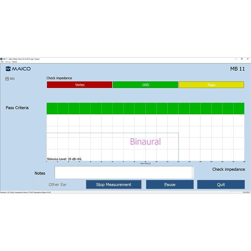 xmb11_classic6_800x800