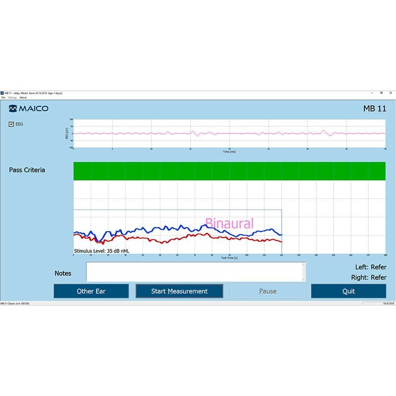 xmb11_classic7_800x800