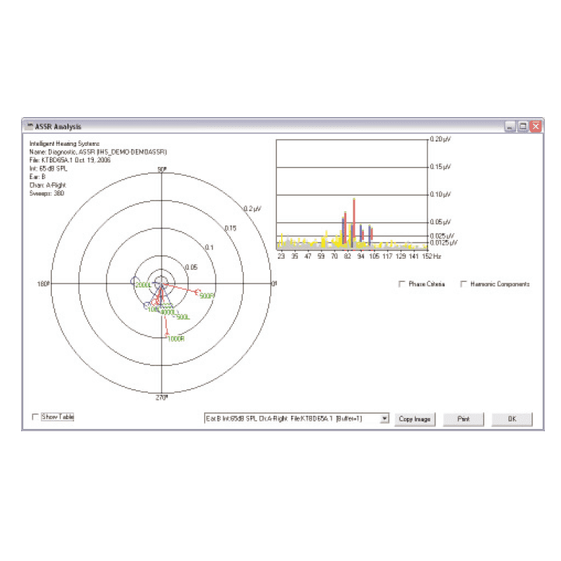 xsmartep_assr_800x800